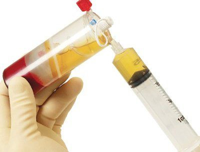 Phân biệt Huyết Thanh và Huyết Tương: Hiểu Rõ Chức Năng Sinh Học Quan Trọng